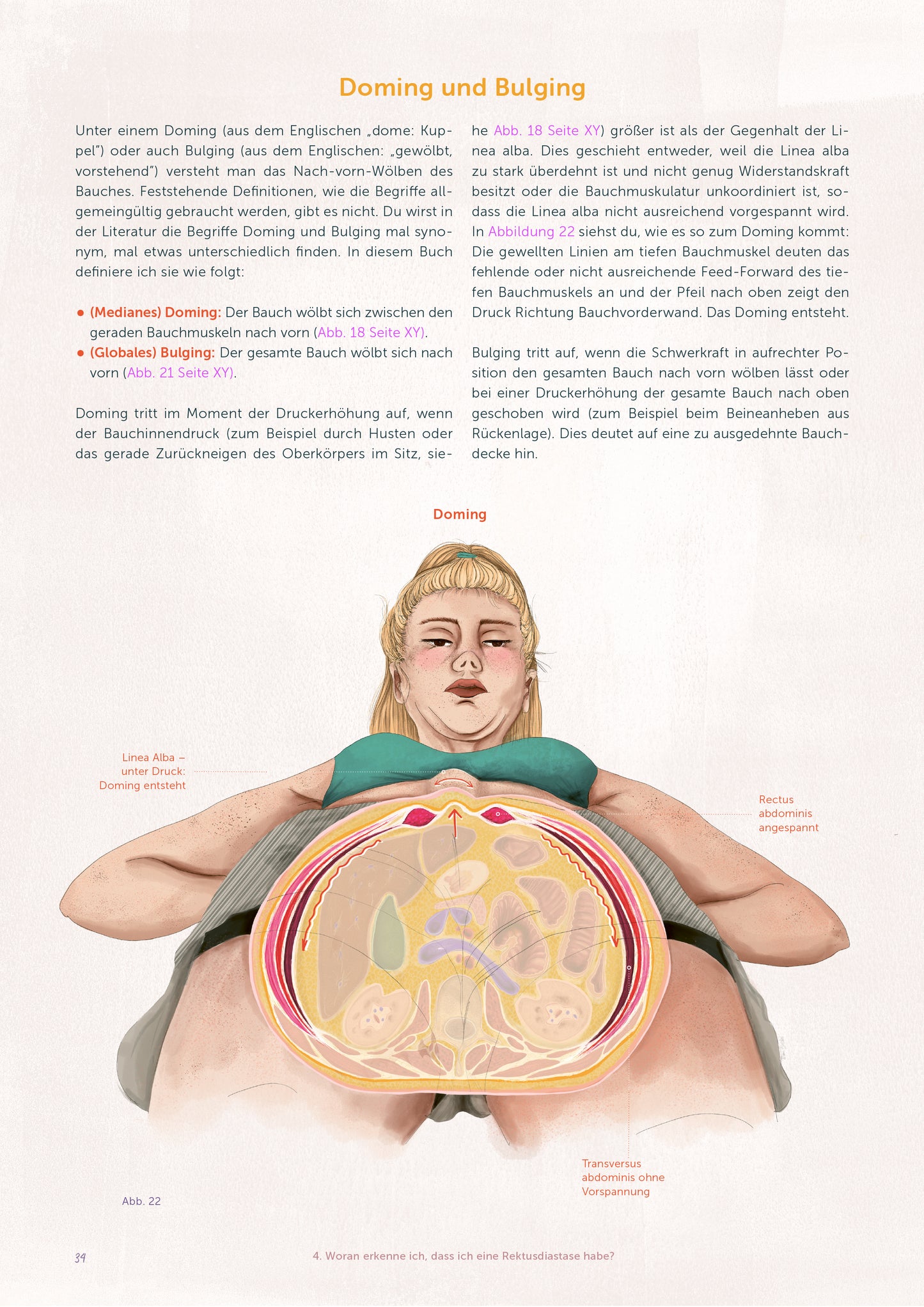 Der Rektusdiastase Guide